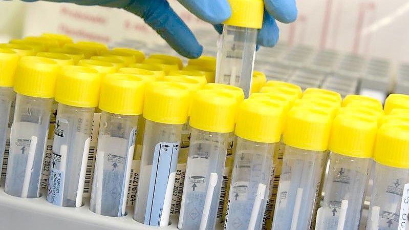 Im Labor wird die Analyse von PCR-Tests vorbereitet. Foto: Waltraud Grubitzsch/dpa-Zentralbild/dpa