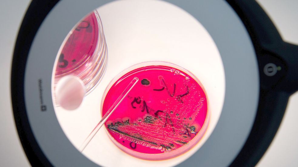 Salmonellen in einer Petrischale im Labor. Foto: Burgi/DPA