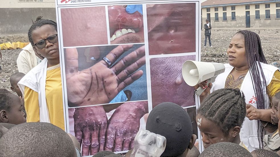 Gesundheitshelfer in der Republik Kongo: Aufklärung über die Mpox-Viren. Foto: picture alliance/dpa/MSF/AP/Augustin Mudiayi