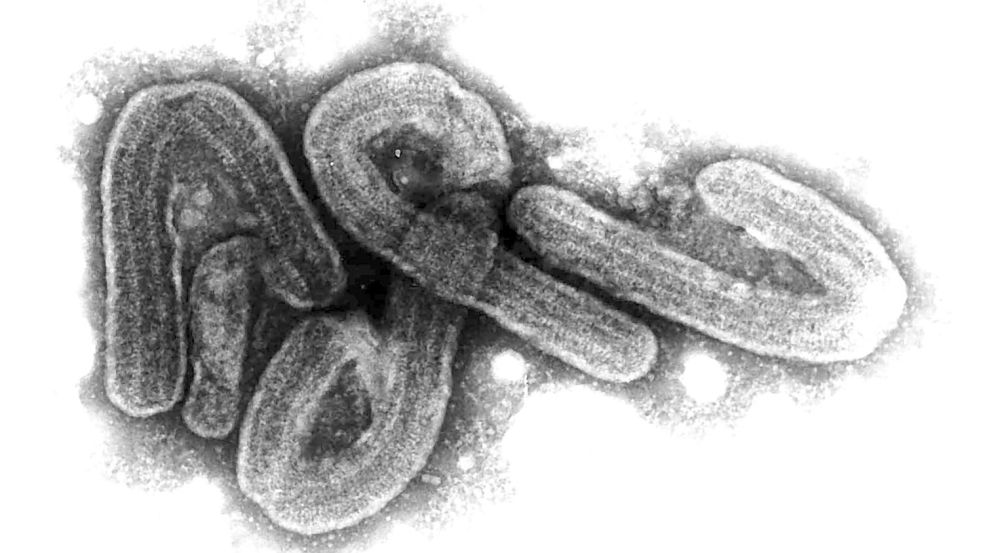 Eine elektronenmikroskopische Aufnahme des Marburg-Virus. Foto: Bernhard-Nocht-Institut/dpa